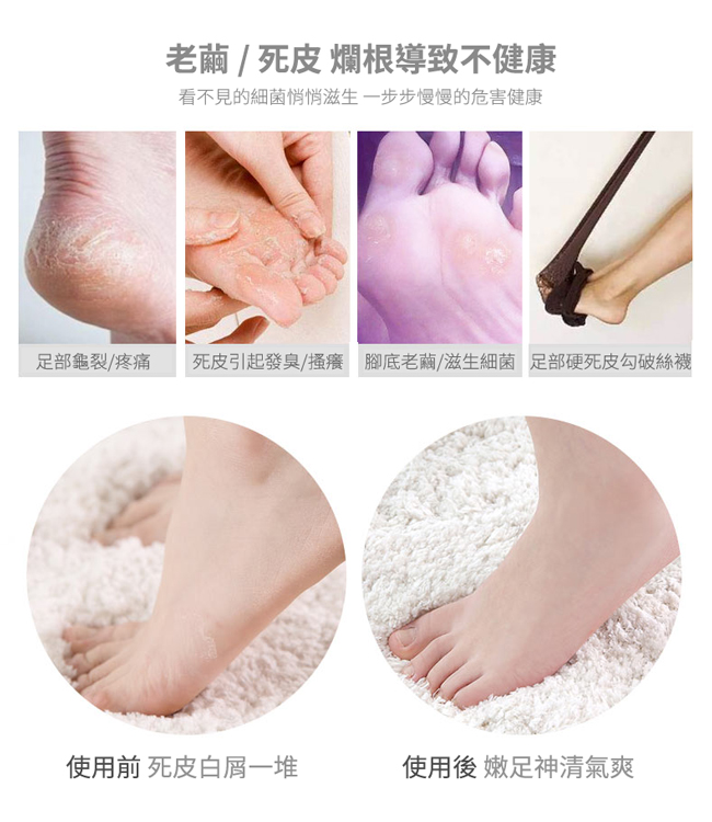 Concern 康生 綺麗美足足部護理機去腳皮 去硬皮藍色con Ft4 Pchome 24h購物 Concern 康生 綺麗美足足部護理機去腳皮 去硬皮藍色con Ft4 Pchome 24h購物